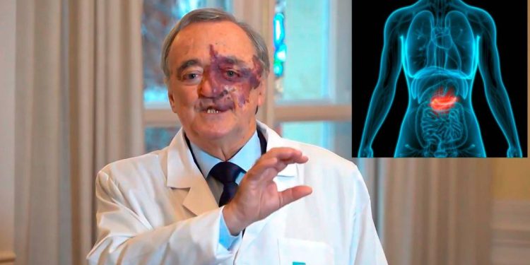 Avances Para La Cura Del Cáncer De Páncreas - Hola Mty